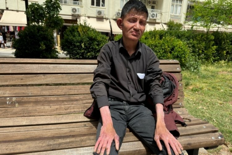 Mardin'de 28 yaşındaki gencin cildinden &ccedil;ıkar yaralar hayatını kabusa &ccedil;evirdi