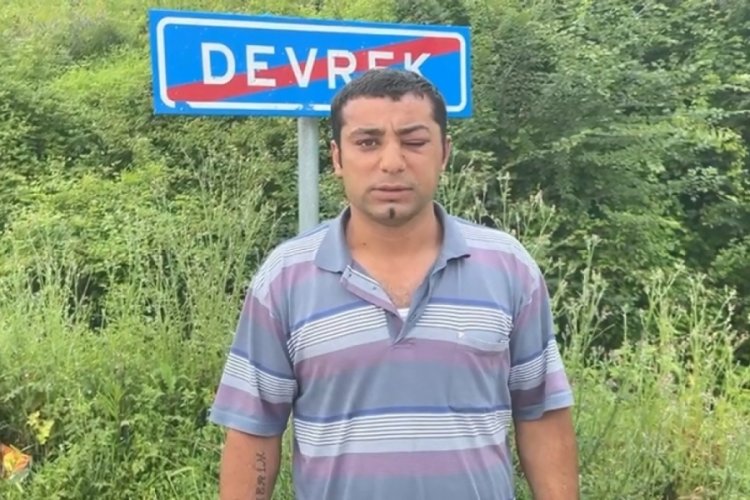 Zonguldak'ta sokakta 15 kişinin saldırısına uğrayan şahıs 'adalet' istedi