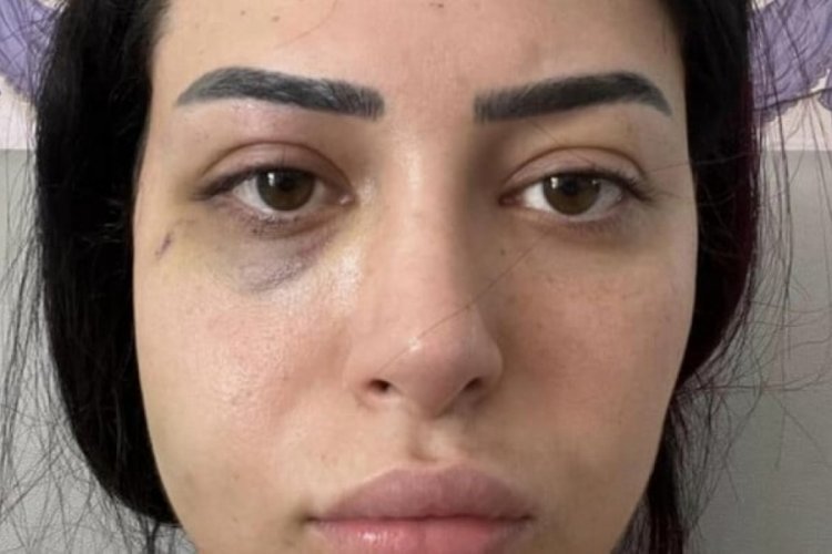 G&uuml;ney Kıbrıs Rum kesiminde T&uuml;rk kızına saldıran 2 Rum tutuklandı!