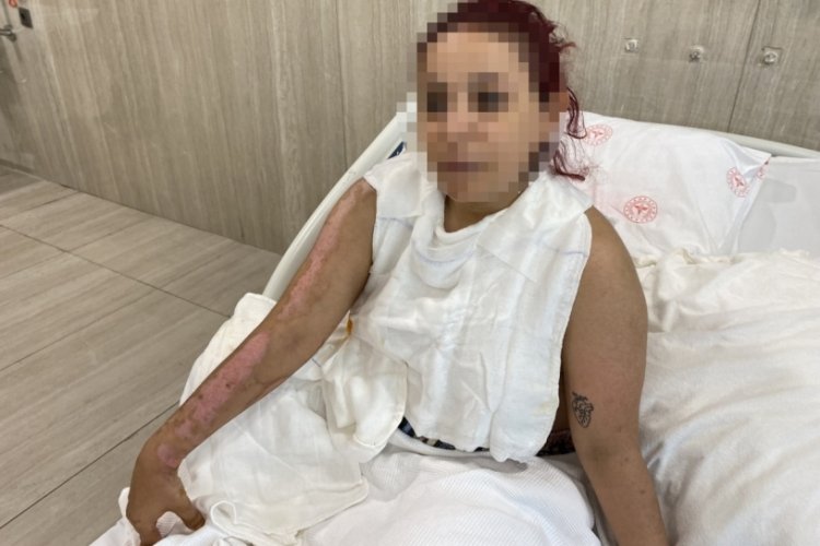 Barda yanan gen&ccedil; kız dehşet anlarını anlattı