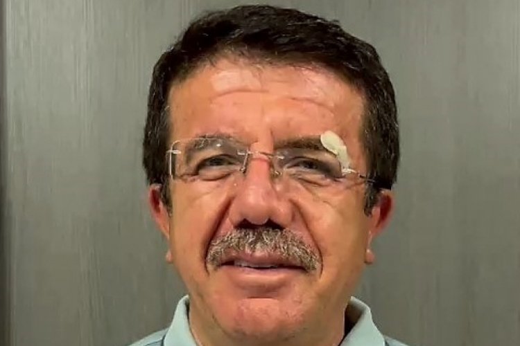 Kaza yapan eski Bakan Zeybekci'den ilk a&ccedil;ıklama!