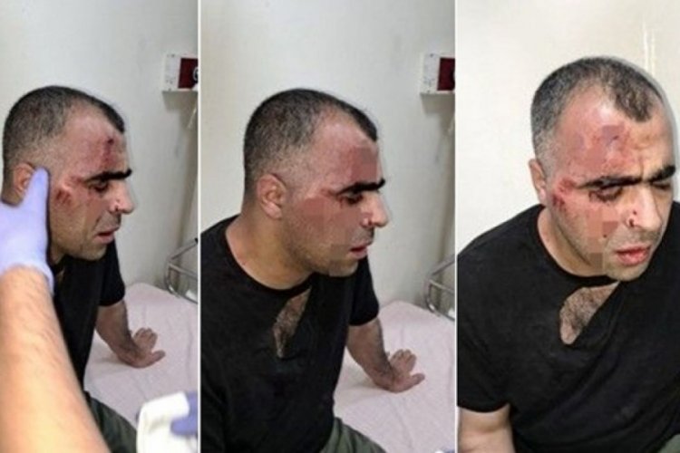 Bitlis'te gazeteciye saldırı! Belediye &ccedil;alışanı ile bir polis a&ccedil;ığa alındı