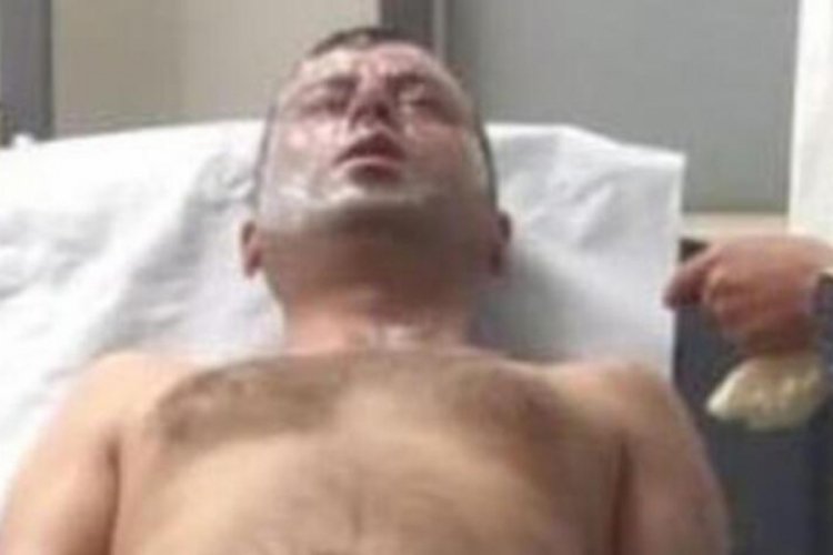 Kocaeli'de tıkanan lavaboyu a&ccedil;ıcıyla a&ccedil;mak istedi! Patlamasıyla yaralandı