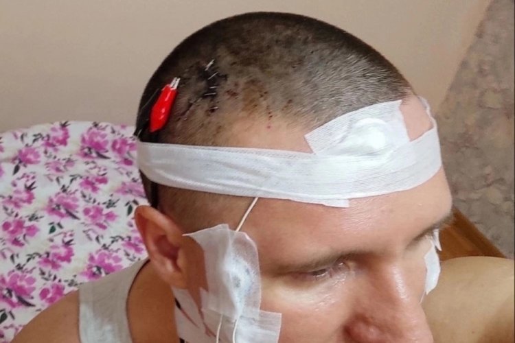 R&uuml;yalarını kontrol etmek isteyen adam matkapla kafatasını deldi