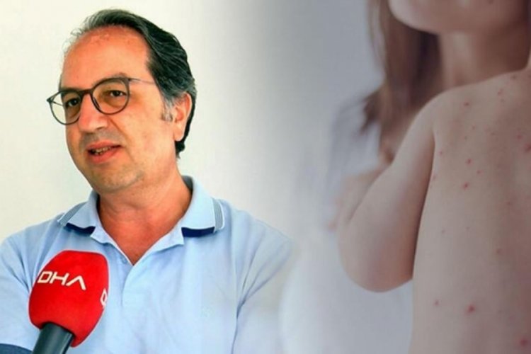 Prof. Dr. Şener: Kızamık masum bir hastalık değil