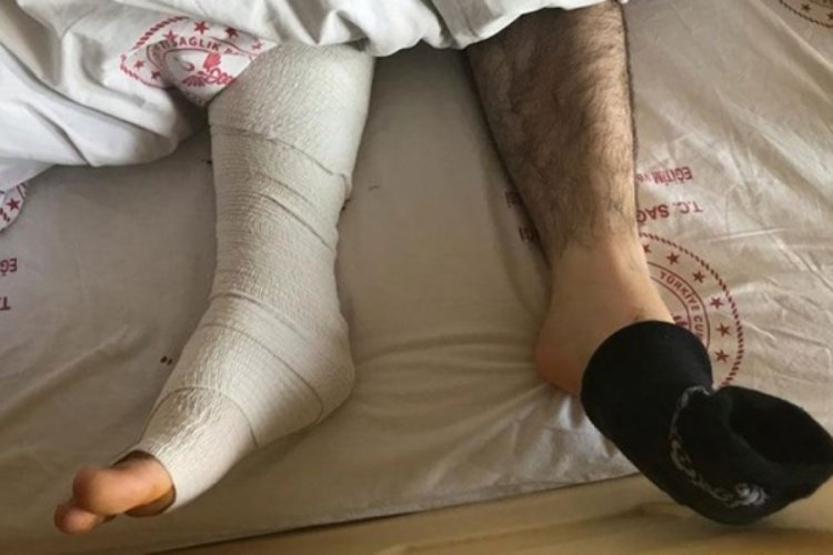 "Sol yerine sağ ayaktan ameliyat ettiler" iddiası