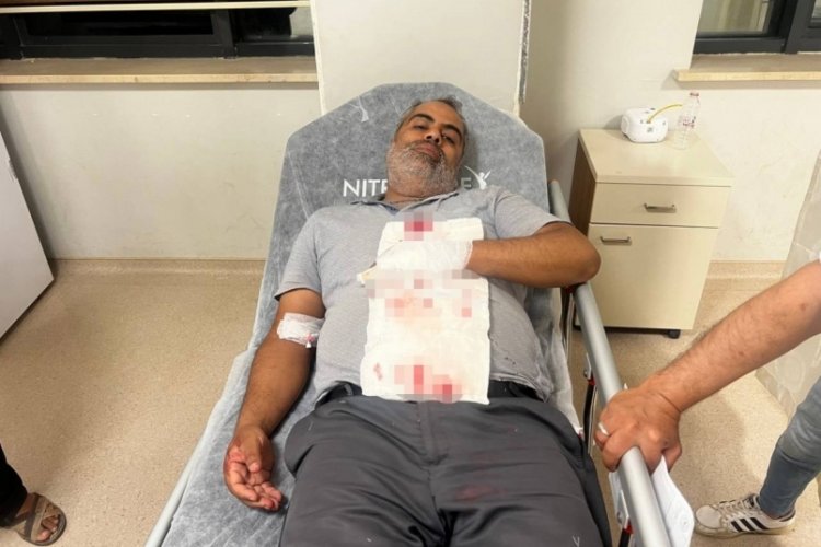 Şanlıurfa'da bah&ccedil;ede otururken yorgun mermi isabet etti