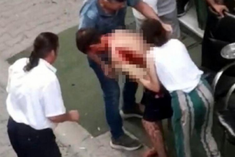 Tekirdağ'da bina sakini ile y&ouml;netici arasında bı&ccedil;aklar konuştu: 1 yaralı