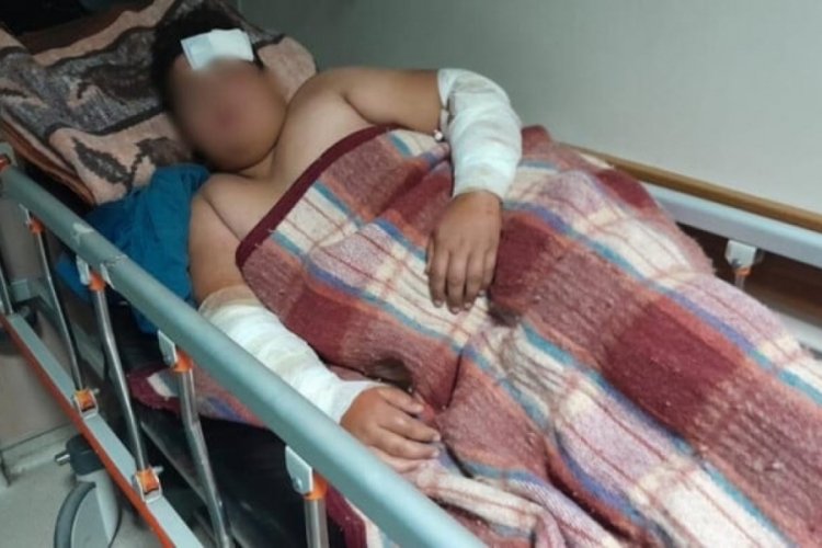 Konya'da sokak k&ouml;peklerinin kovaladığı &ccedil;ocuk yaralandı