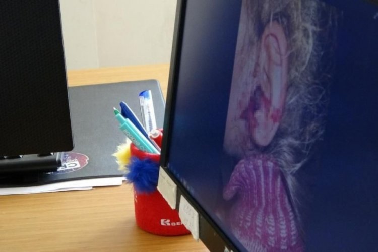 3 yaşındaki kızın kulağından &ccedil;ıkan dehşete d&uuml;ş&uuml;rd&uuml;!