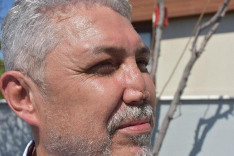 Doktor arkadaşına g&uuml;venip burun estetiği yaptırdı, bu hale geldi!