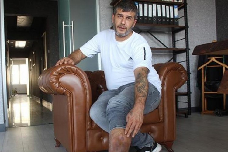 Kayseri'de 16 yıl &ouml;nce ameliyat oldu, bacağında kumaş par&ccedil;ası &ccedil;ıktı