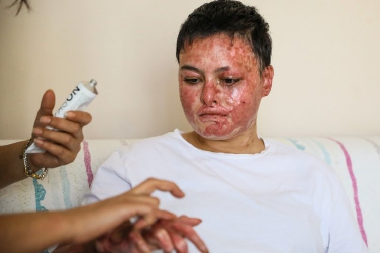 Liseli Beyzanur sanayideki işine d&ouml;nmek istiyor