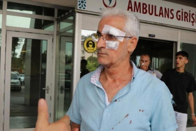 Taksici &ouml;ğretmene dehşeti yaşattı! Y&uuml;z&uuml;ne 7 dikiş atıldı