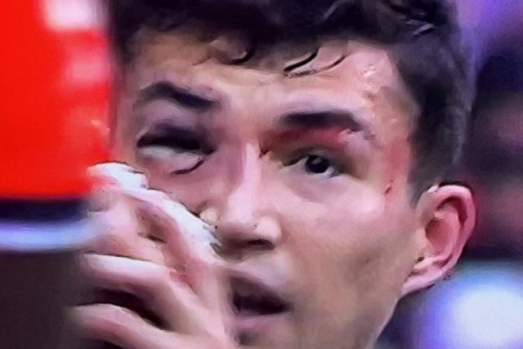 Bahtiyar Zaynutdinov'un g&ouml;z&uuml; morardı, kaşı a&ccedil;ıldı