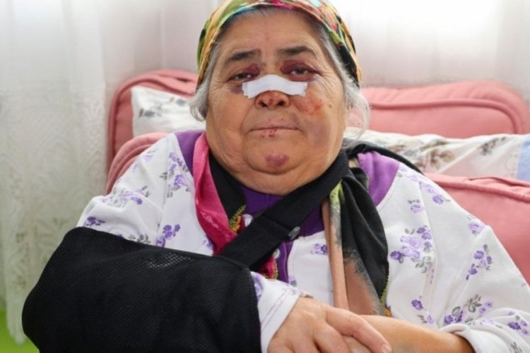 Adana'da yolun karşısına ge&ccedil;meye &ccedil;alışan yaşlı kadına otomobil &ccedil;arpıp ka&ccedil;tı