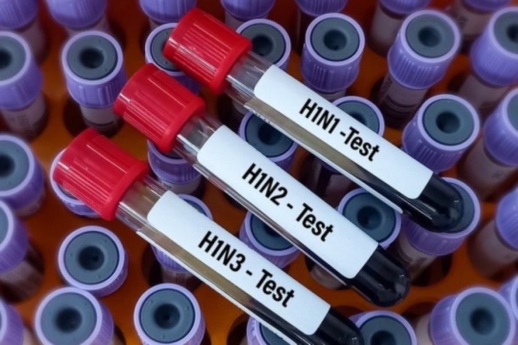 İngiltere'de H1N2 grip t&uuml;r&uuml; ilk kez insanda g&ouml;r&uuml;ld&uuml;