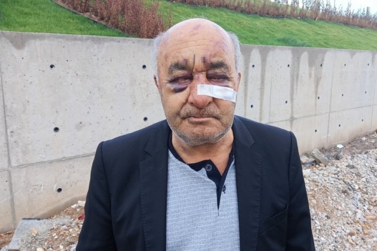 Ankara'da &ouml;ld&uuml;resiye d&ouml;v&uuml;len taksici korku dolu o anları anlattı