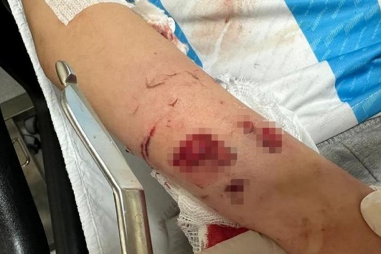 12 yaşındaki &ccedil;ocuk, sevdiği k&ouml;peğin saldırısına uğradı