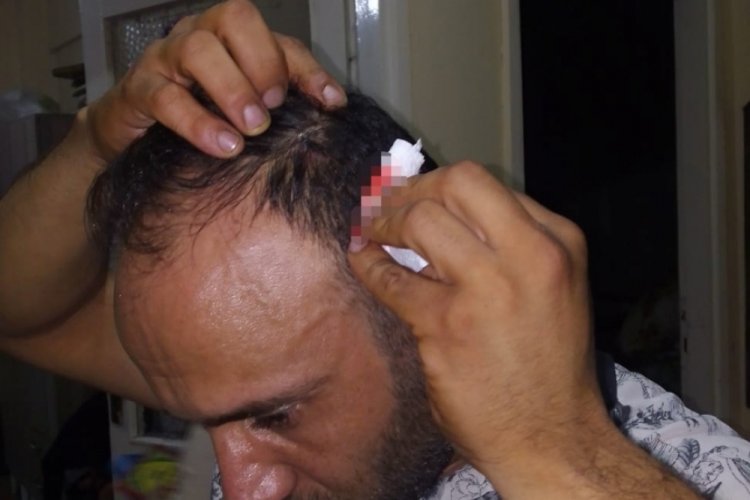 İstanbul'da ev sahibinin oğlu, kira zammını kabul etmeyen kiracısını darp etti!