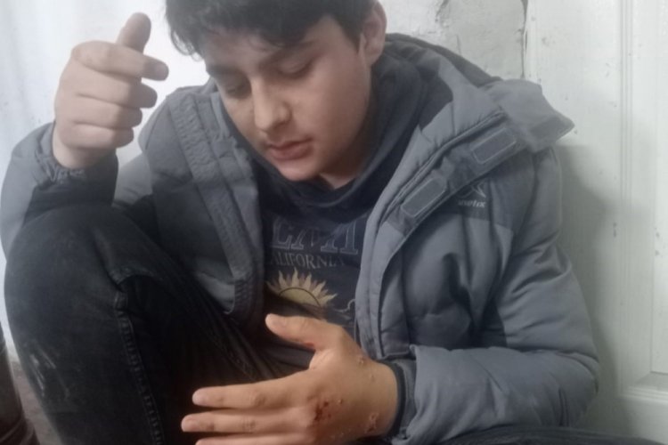 Malatya'da depremde panikleyerek evin balkondan atlayan &ccedil;ocuk yaralandı