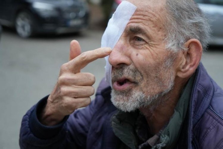 Sinop'ta y&uuml;z&uuml; eriyen adamın yardım &ccedil;ığlığı: Suratım mum gibi eriyor, g&ouml;z&uuml;m akıyor