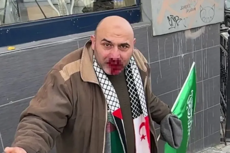 İsrail'i protesto eden vatandaşa saldıran provokat&ouml;r i&ccedil;in istenen ceza belli oldu