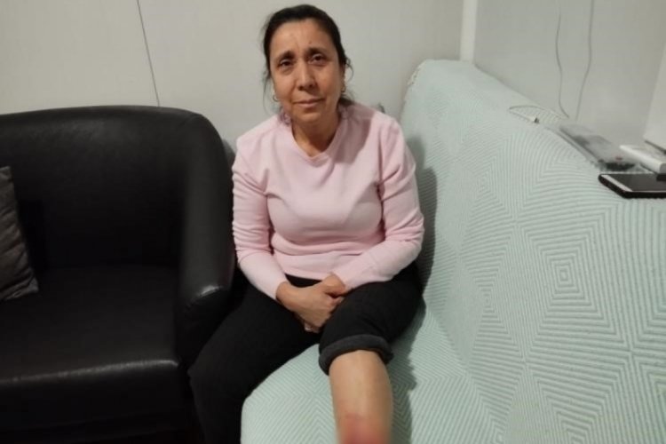 K&ouml;pek saldırısına uğrayan kadının bacağında yarık oluştu