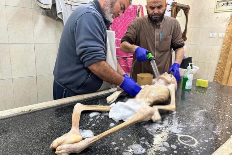 İnsanlık tarihini utandıracak fotoğraf!