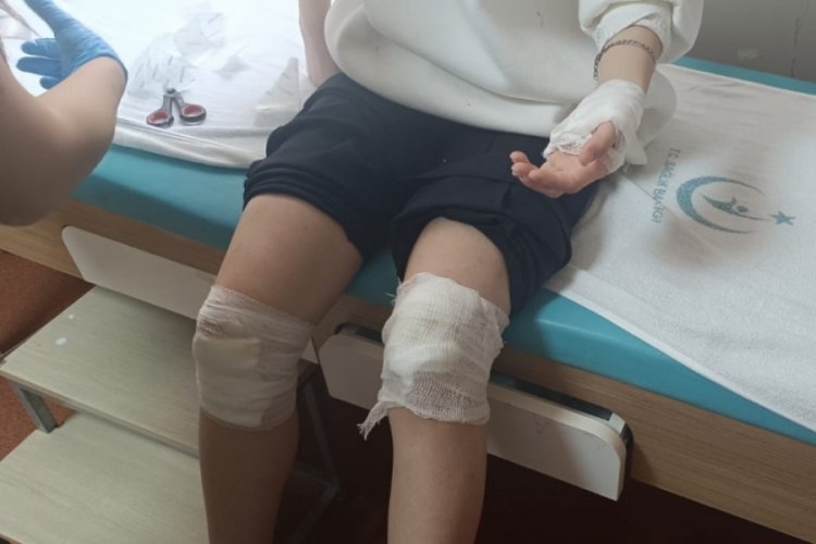 Elazığ'da 17 yaşındaki genç kız sokak köpeklerinin saldırısına uğradı!