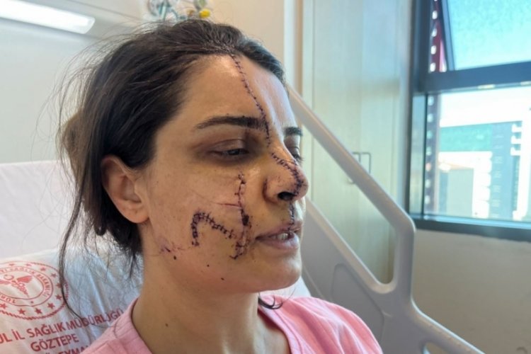 İstanbul'da saldırıya uğrayan kadın y&uuml;z&uuml;ndeki 40 dikişle dehşet dolu anları anlattı