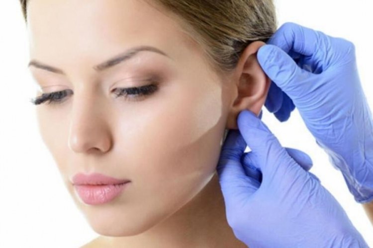Kepçe kulak nedir, nasıl düzelir? Kepçe kulak ameliyatı nasıl yapılır?