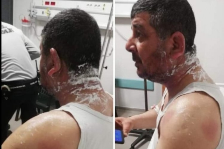 DP'li Belediye Meclis &Uuml;yesi Adayına asitli saldırı!&nbsp;