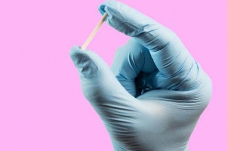 Koluna takılan doğum kontrol implantını kaybetti: 6 yıl sonra akciğerinden &ccedil;ıktı!