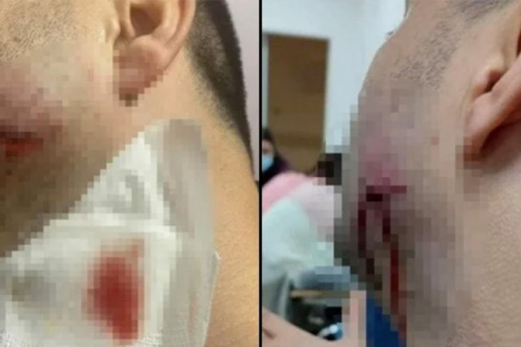 Tekirdağ'da sağlık &ccedil;alışanlarına saldırı iddiası! Jandarma personeli a&ccedil;ığa alındı
