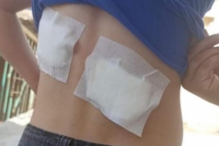 Diyarbakır'da 8 yaşındaki &ccedil;ocuğa sokak k&ouml;pekleri saldırdı