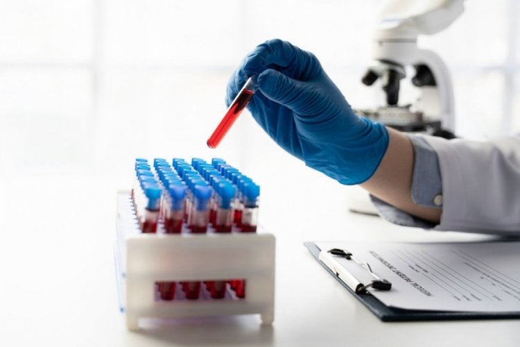 İngiltere'de skandal: 30 bine yakın insan, HIV veya Hepatit C bulaşmış kanla tedavi edildi