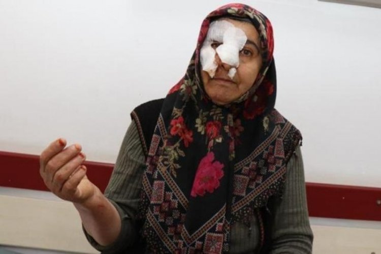 Erzurum'da k&ouml;pekler 53 yaşındaki kadına saldırdı!