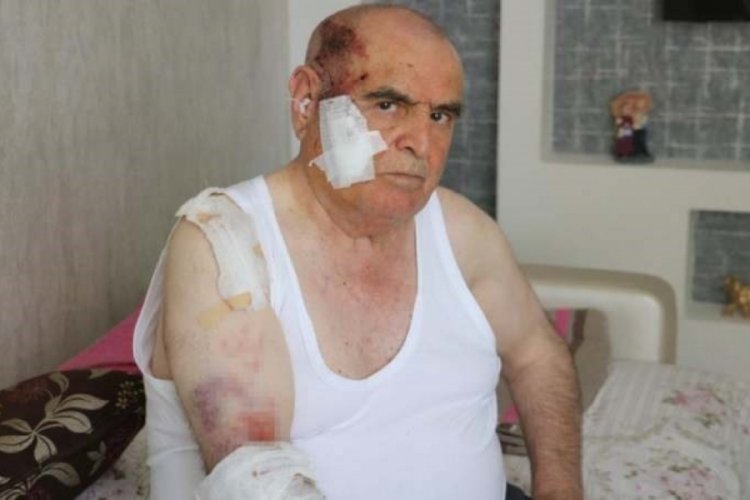 "Sivas Belediyesi'ne ait tanker yurttaşa &ccedil;arpıp ka&ccedil;tı" iddiası
