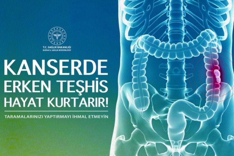 Kolon kanseri Bursa'da ele alınacak