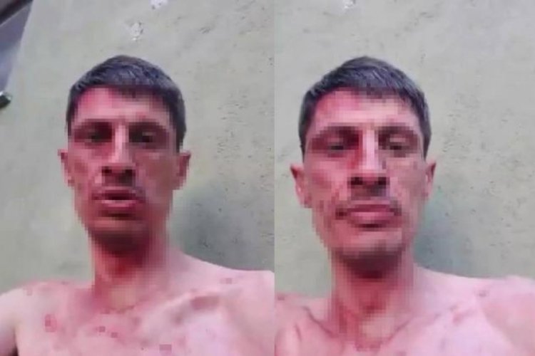 Canlı yayın a&ccedil;ıp eniştesini yaraladı: 30 dakika boyunca aynı şarkı &ccedil;aldı