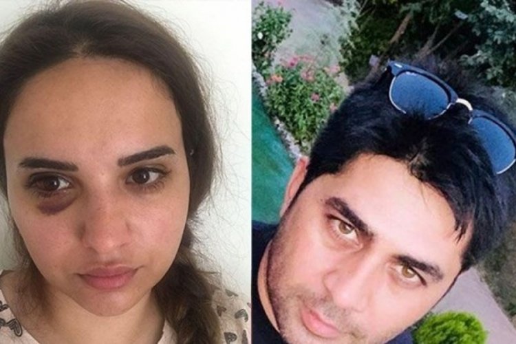 Bir yıldır boşanmak istiyordu, ne yaptıysa kurtulamadı!