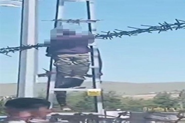 Kayseri'de kurban pazarında zabıta ile tartışınca kendini asmıştı: Taburcu edildi