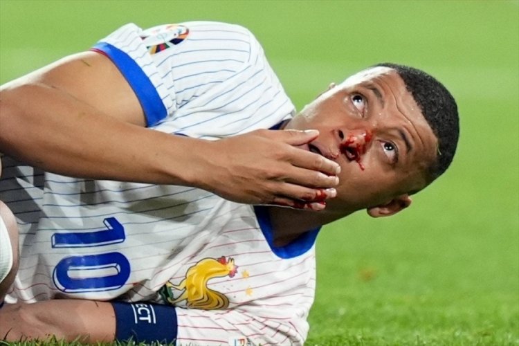 EURO 2024'te talihsiz an: Mbappe'nin burnu kırıldı
