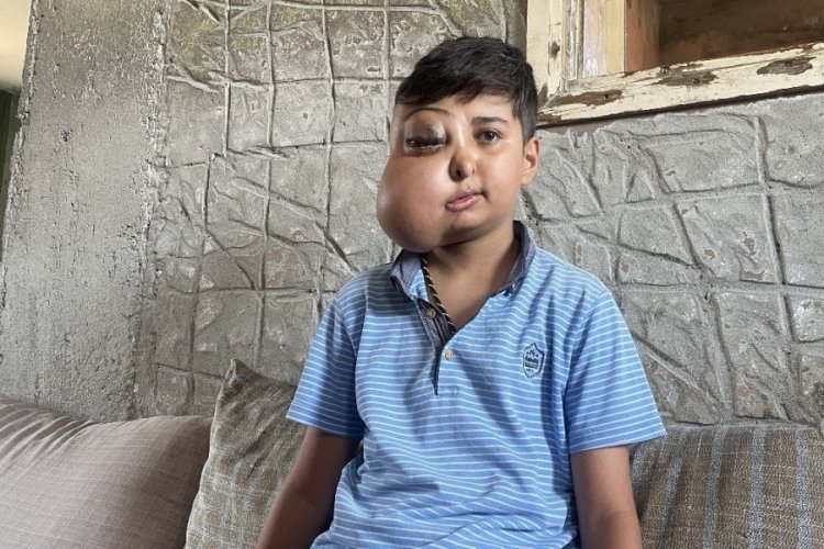 Adanalı Enes tedavi olmak istiyor