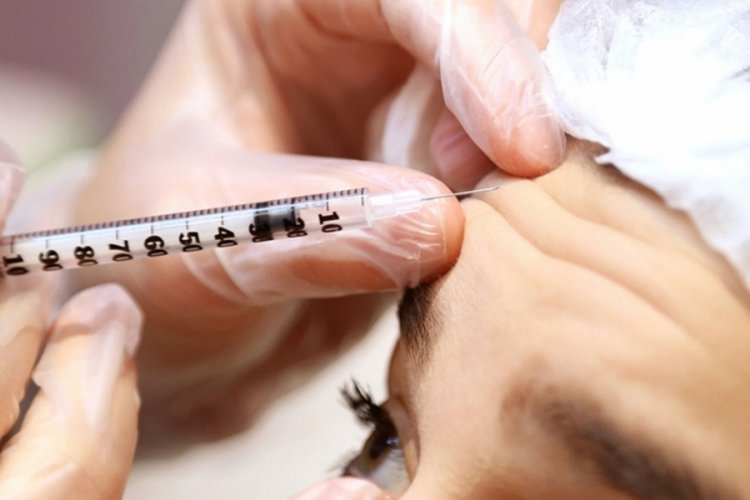 Yanlış uygulanan botoks i&ccedil;in 1500 TL ceza