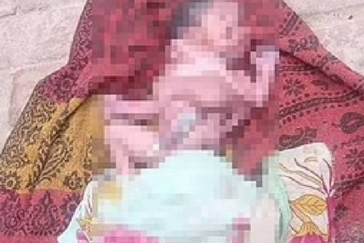4 bacak, 4 kol ve 2 y&uuml;zle d&uuml;nyaya geldi!