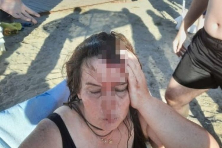 Halk Plajında y&uuml;zerken kafasına jet ski &ccedil;arptı!