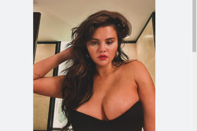 Selena Gomez: Botoks yaptırdım, beni rahat bırakın!
