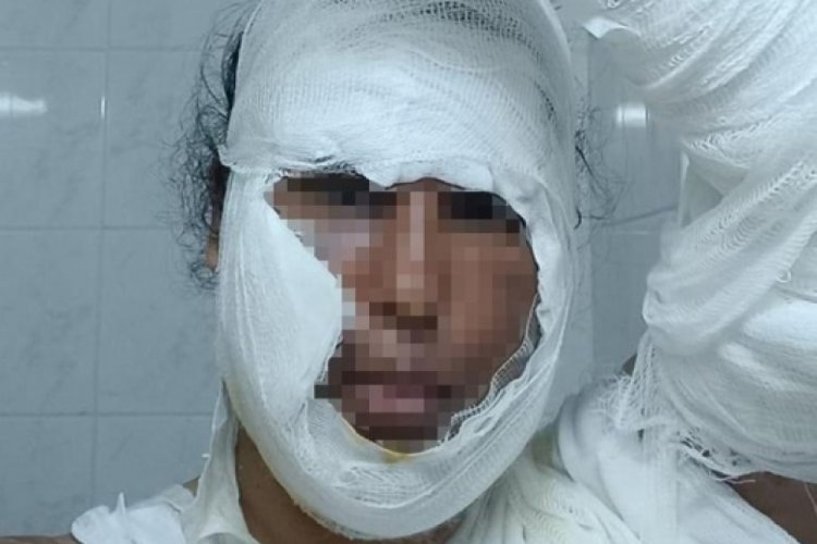 İstanbul'dan gelen g&ouml;r&uuml;mce k&acirc;busu yaşattı: Kaynar suyu y&uuml;z&uuml;ne d&ouml;kt&uuml;